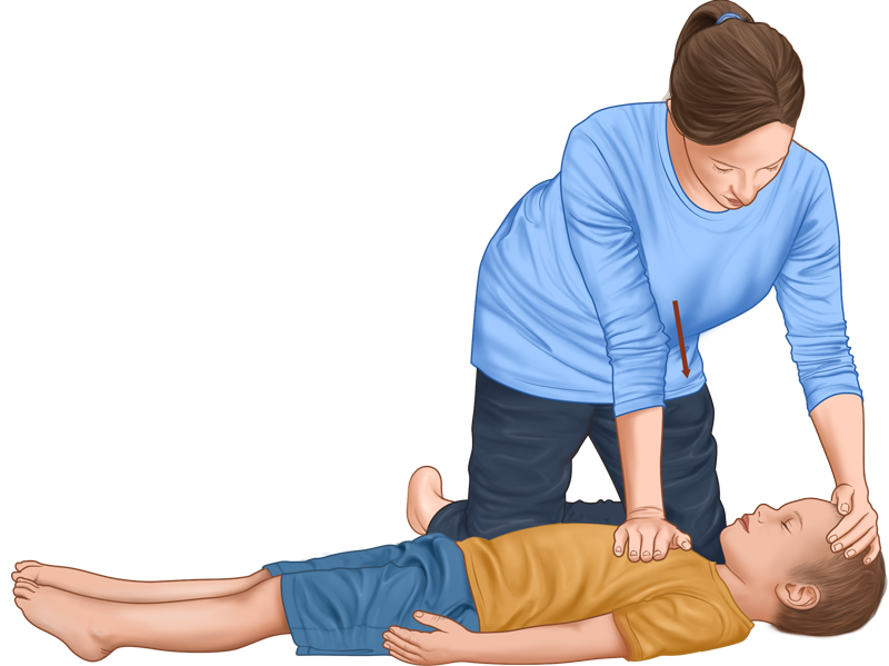 What's Ideal Cpr Chest Compression Rate? Save Lives